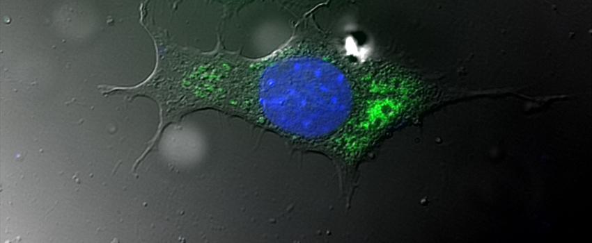 DIC and fluorescent microscopy images overlaid to show the entire host cell (gray with blue nucleus) and intracellular bacteria (green).